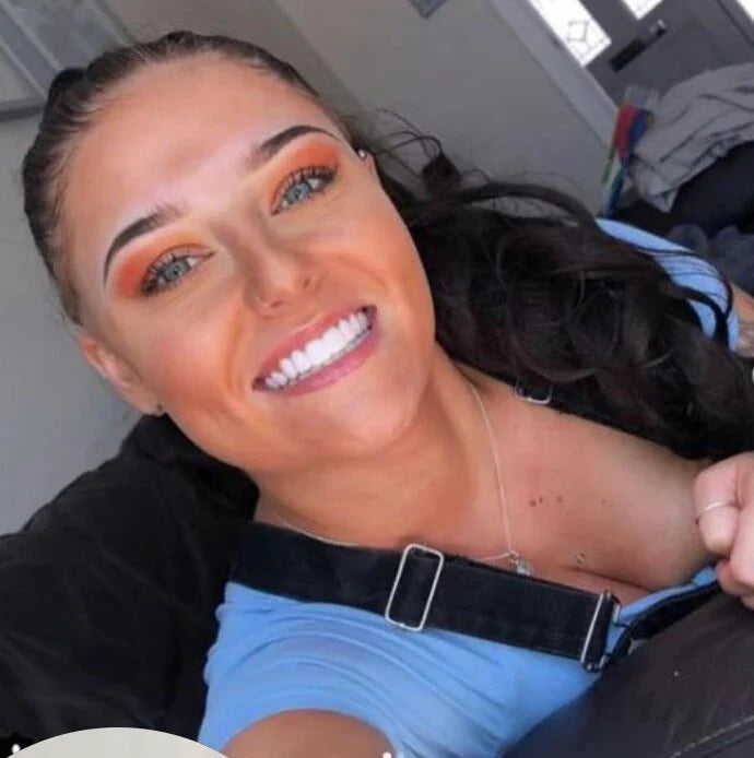 files/imgi_18_Review_4_Veneers.jpg