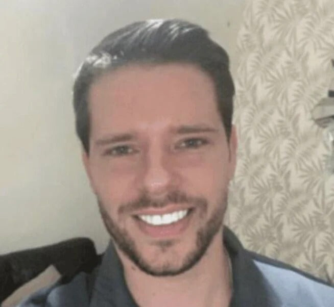 files/imgi_20_Review_6_Veneers.jpg